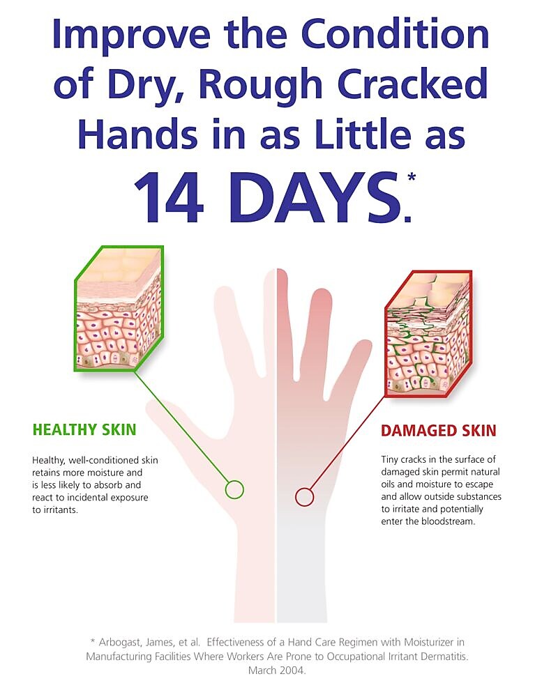 GOJO HAND MEDIC Professional Skin Conditioner, 685 mL,  4/Carton (8745-04)