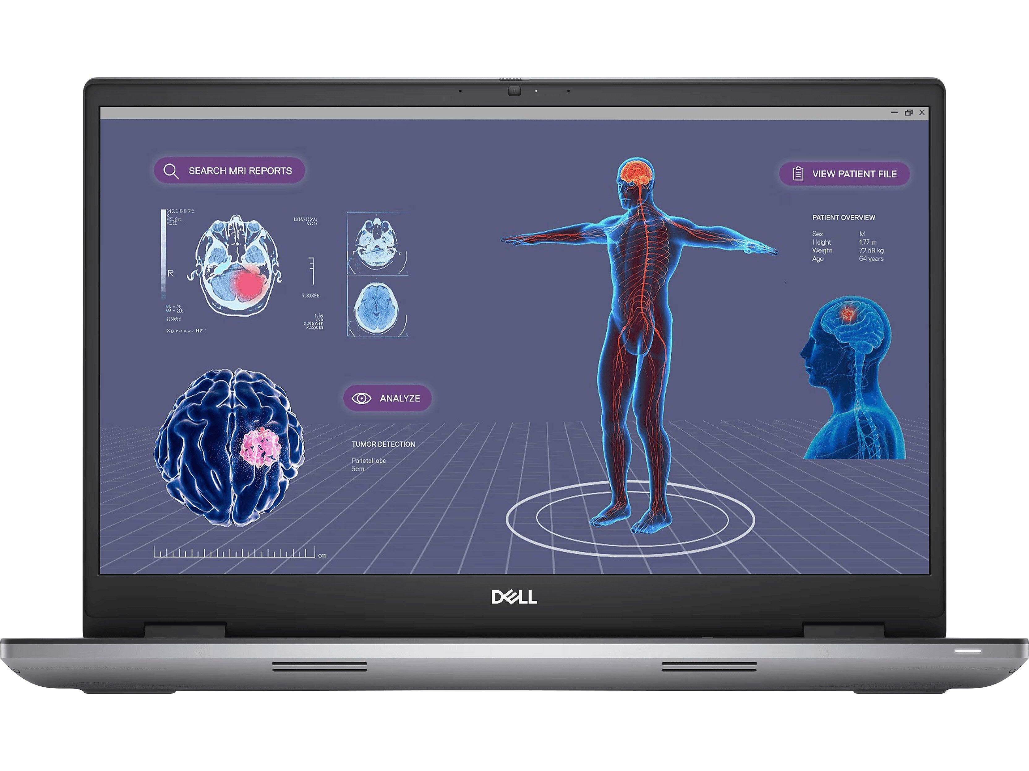 Dell Precision 7780 17.3" Laptop, Intel Core i7-13850HX, 32GB Memory, 512GB SSD, Windows 11 Pro (26DYG)