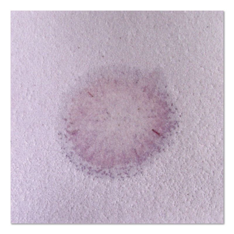 Acid Neutralizer Pads, 11" x 12", 10/Pack (ACIDPAD10)