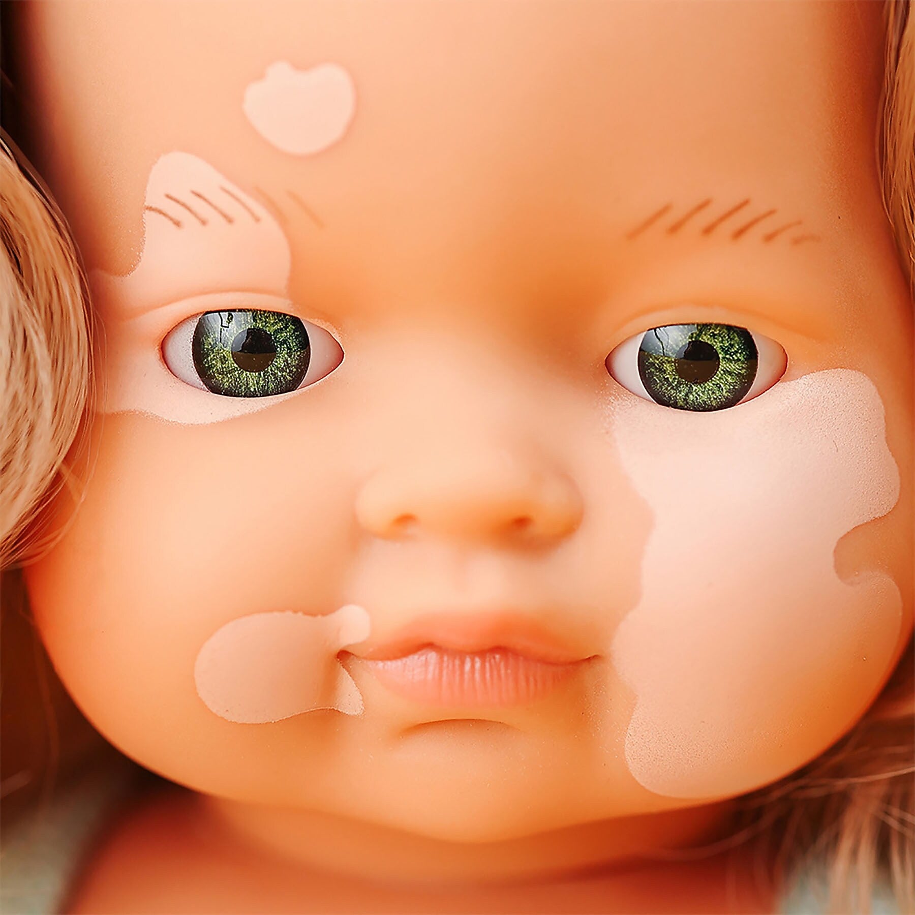 MINILAND Anatomically Correct 15" Baby Doll, Caucasian Blonde Girl with Vitiligo (MLE31228)