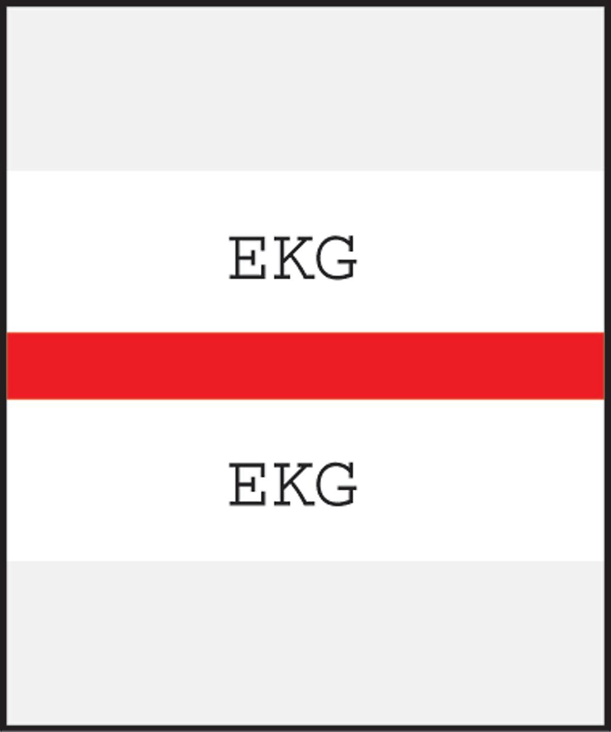 Medical Arts Press® Standard Preprinted Chart Divider Tabs; EKG, Red