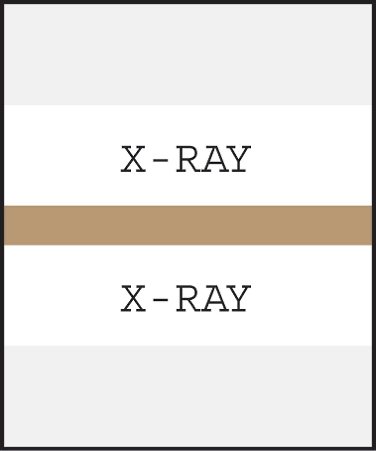 Medical Arts Press® Standard Preprinted Chart Divider Tabs; X-Ray, Tan